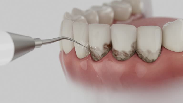 Trusted Invisalign Clear Aligners service in Throop, PA - Dentist Open Now